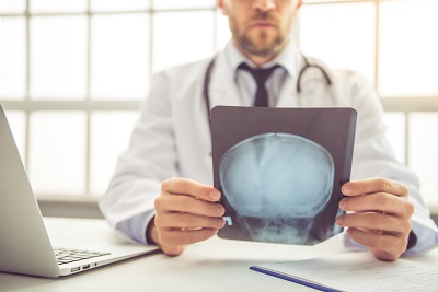 Doctor looking at brain scan of traumatic brain injury